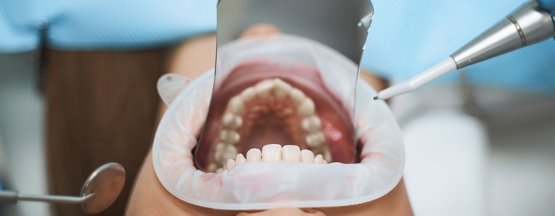 Clínica Dental Andrea Compte, tu Centro Odontológico especializado. Odontología estética en Alcossebre. Paciente recibiendo tratamiento dental estético.