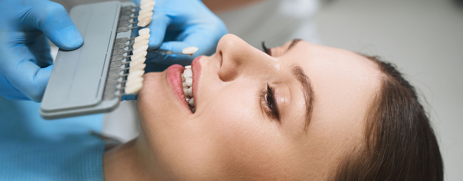 Clínica Dental Andrea Compte, tu Centro Odontológico especializado. Odontología estética en Sant Jordi. Mujer escogiendo tono para el blanqueamiento dental.
