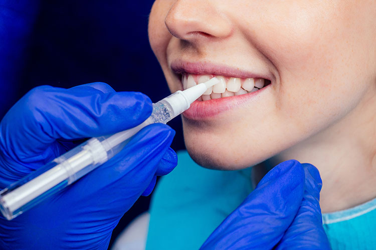 Clínica Dental Andrea Compte, tu Centro Odontológico especializado. Odontología estética en Vinaròs. Dentista aplicando tratamiento al paciente.