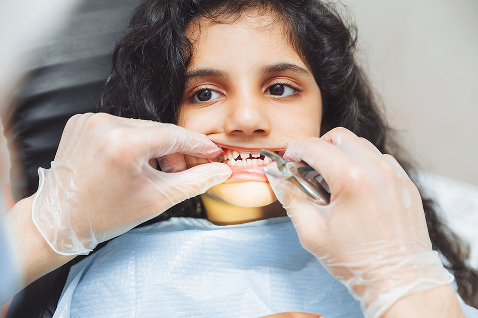 Clínica Dental Andrea Compte, tu Centro Odontológico especializado. Odontopediatría en Alcossebre. Dentista hace un examen de los dientes de una niña pequeña.