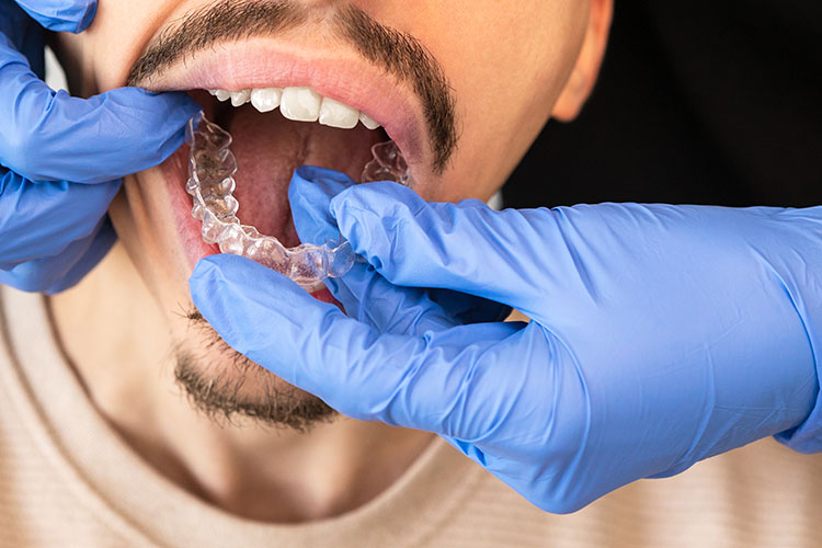 Clínica Dental Andrea Compte, tu Centro Odontológico especializado. Ortodoncia en Cervera del Maestre. Especialista en ortodoncia ajustando alineadores invisibles al paciente.