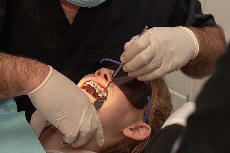 Clínica Dental Andrea Compte, tu Centro Odontológico especializado. Ortodoncia en Sant Jordi. Ortodoncista quitando los tirantes metálicos de los brackets.