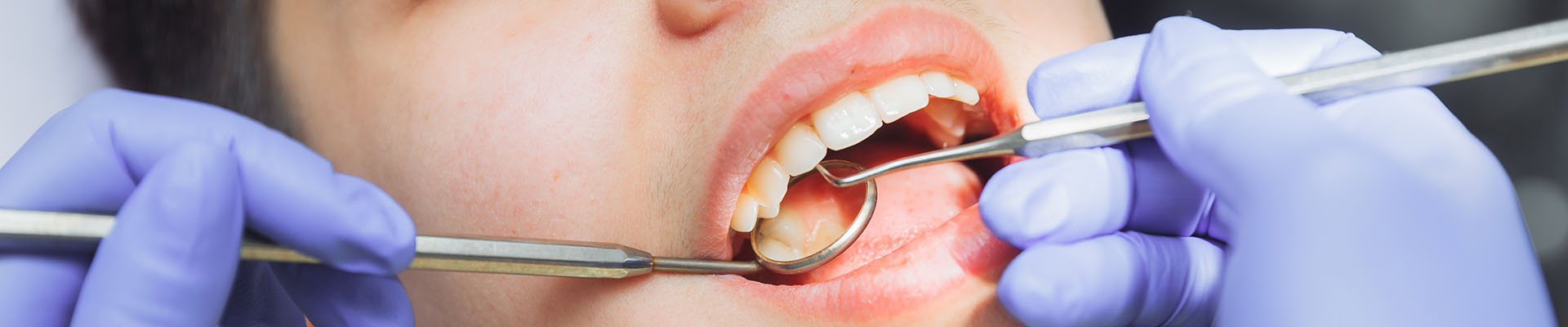 Clínica Dental Andrea Compte, tu Centro Odontológico especializado. Odontopediatría en Cálig. La dentista examina al niño.